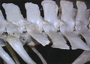 Perspectiva lateral de la columna vertebral lumbar y sus procesos espinosos y transversales